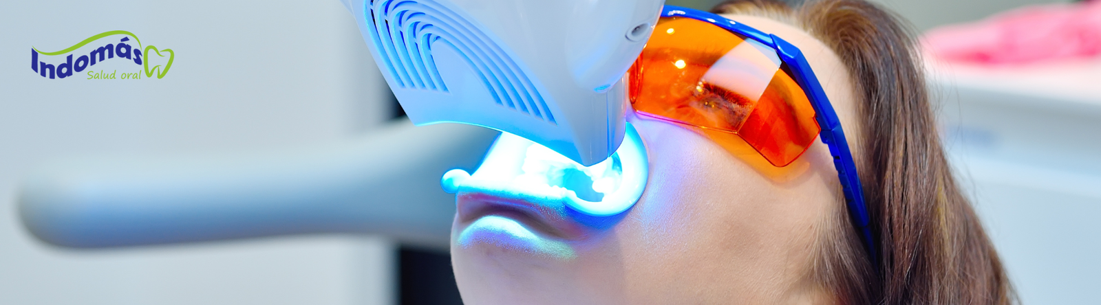 Blanqueamiento Dental
