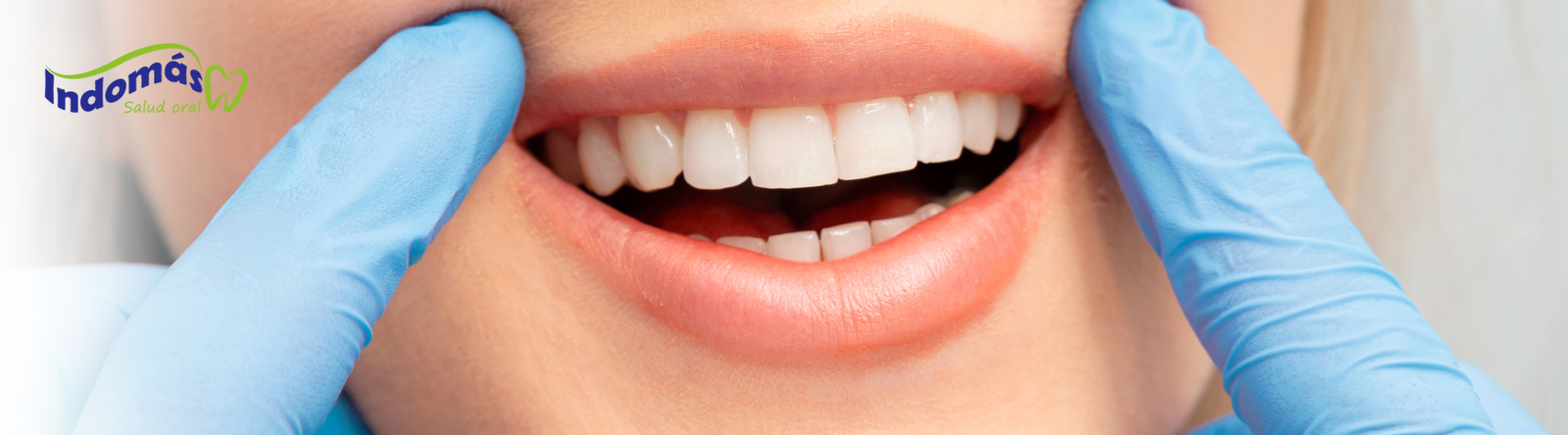 Cortoneado Dental